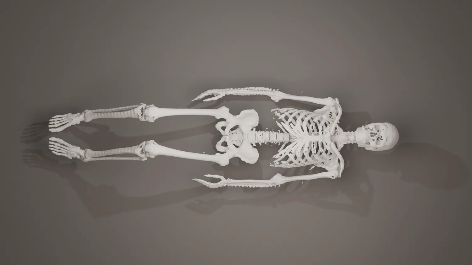 3D skeletal rendering from patient imaging